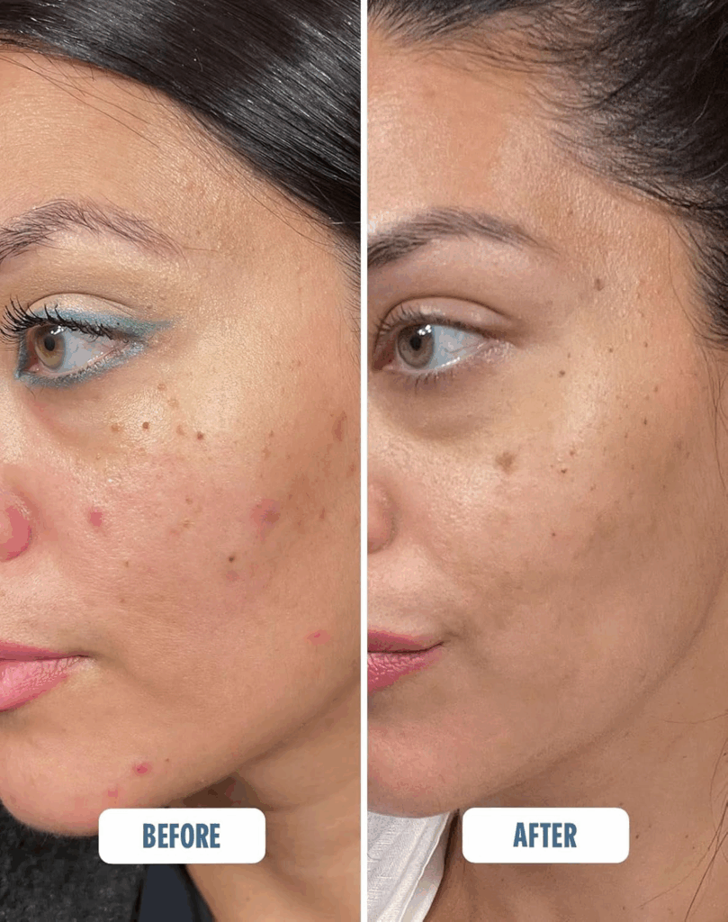 The Skin Calming Spray Everyone With Sensitive Skin Needs to Try Beauty