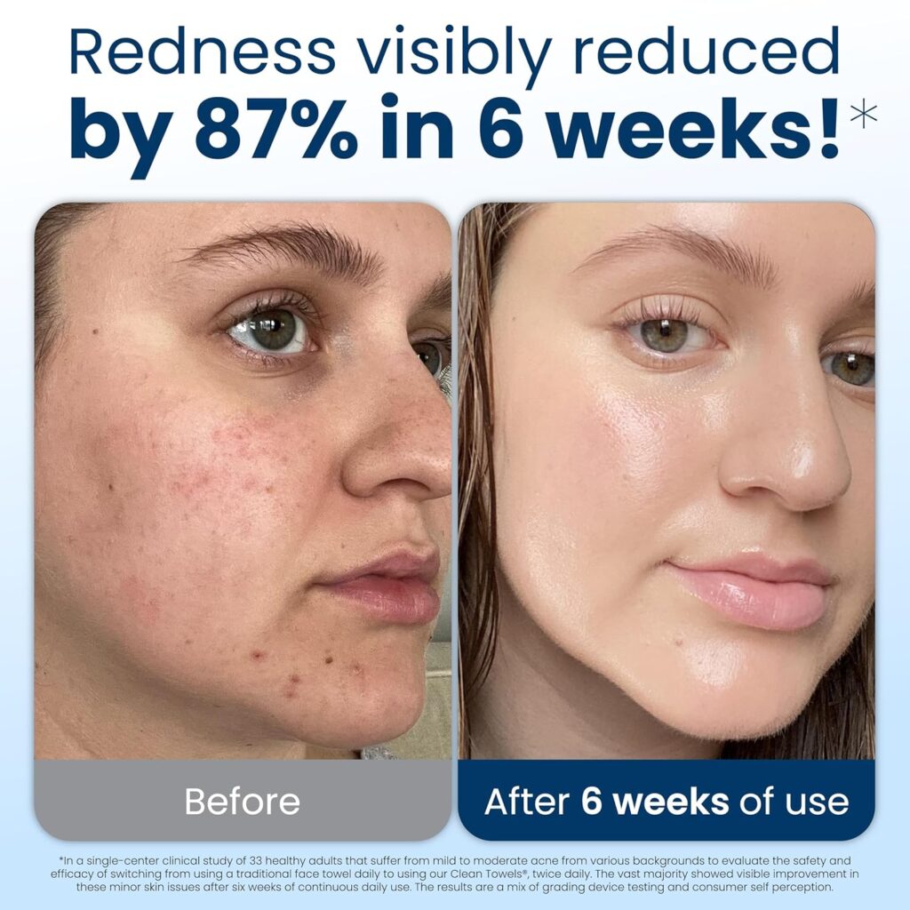 Everyday Habits That May Be Causing Your Breakouts Beauty, Health & Wellness