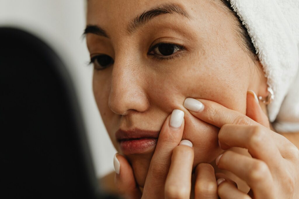 Everyday Habits That May Be Causing Your Breakouts Beauty, Health & Wellness