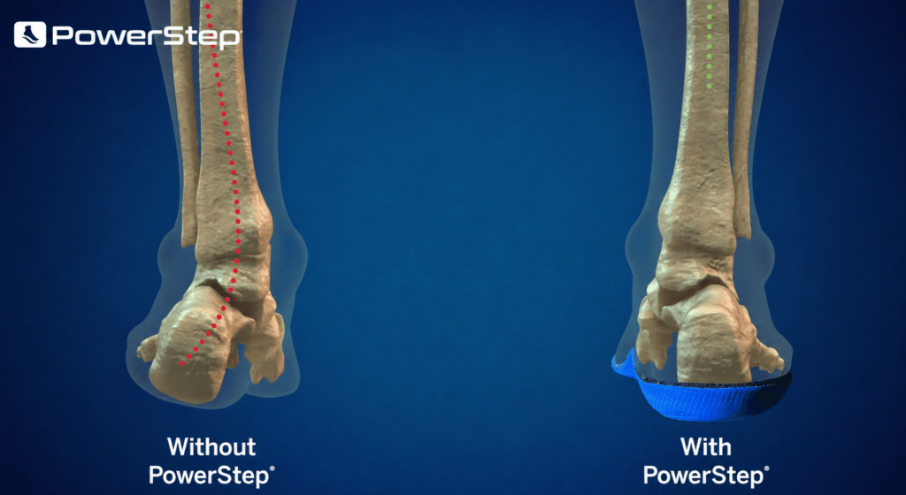The Answer to Tired, Achy Feet Might Be Hiding in Your Shoes 5 The Answer to Tired, Achy Feet Might Be Hiding in Your Shoes Health & Wellness