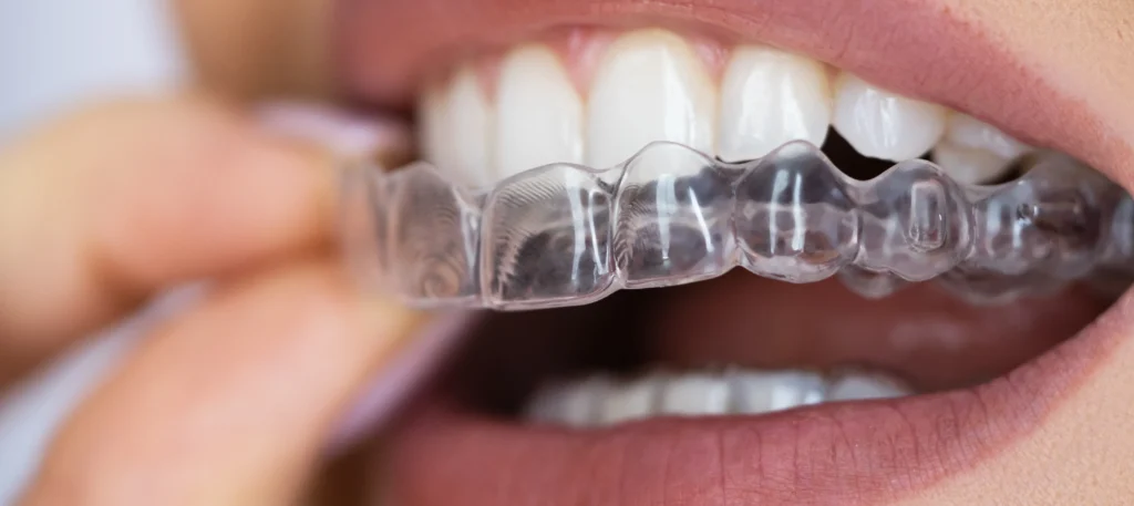 Small Changes That Can Make a Big Difference in Your Smile Health & Wellness